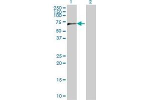Western Blotting (WB) image for anti-Cleavage and Polyadenylation Specific Factor 6, 68kDa (CPSF6) (AA 37-136) antibody (ABIN524445)