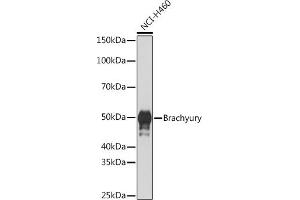 Western blot analysis of extracts of NCI-H460 cells, using Brachyury Rabbit mAb (ABIN1682626, ABIN3019362, ABIN3019363 and ABIN7101757) at 1:1000 dilution. (Scinderin 抗体)