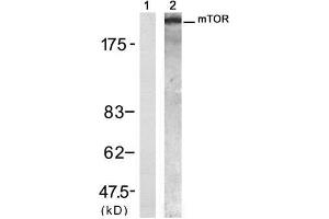 Western blot analysis of extract from 293 cell, using mTOR (Ab-2448) Antibody (E021214, Lane 1 and 2). (MTOR 抗体)