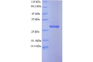 SDS-PAGE (SDS) image for SAM Domain and HD Domain 1 (SAMHD1) (AA 395-626) protein (His tag) (ABIN5710314)