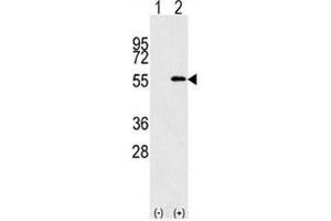 Western blot analysis of NUP50 antibody and 293 cell lysate (2 ug/lane) either nontransfected (Lane 1) or transiently transfected with the NUP50 gene (2). (NUP50 抗体  (AA 432-461))