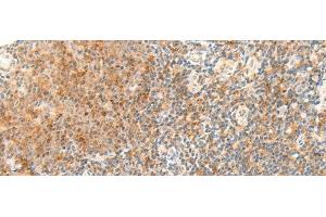 Immunohistochemistry of paraffin-embedded Human tonsil tissue using RAPGEF1 Polyclonal Antibody at dilution of 1:45(x200) (GRF2 抗体)