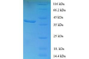 SDS-PAGE (SDS) image for Forkhead Box P1 (FOXP1) (AA 1-114), (partial) protein (GST tag) (ABIN5709535)