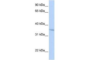 FHL3 antibody used at 0.