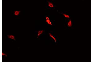ABIN6269031 staining CACO-2 cells by IF/ICC. (PDGFRA 抗体  (C-Term))
