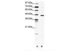 Image no. 1 for anti-gamma-aminobutyric Acid (GABA) A Receptor, pi (GABRP) (AA 28-77) antibody (ABIN202529) (GABRP 抗体  (AA 28-77))
