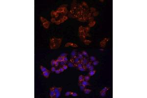 Immunofluorescence (IF) image for anti-FK506 Binding Protein 5 (FKBP5) (AA 308-457) antibody (ABIN1679852)