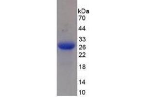 Image no. 1 for Mannan-Binding Lectin serine Peptidase 2 (MASP2) (AA 445-683) (Active) protein (His tag) (ABIN6239794)