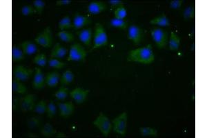 Immunofluorescence staining of Hela cells with ABIN7146194 at 1:100, counter-stained with DAPI. (E-cadherin 抗体  (AA 155-707))