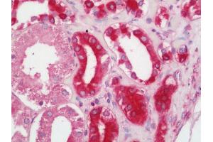 Immunohistochemistry (IHC) image for anti-STIP1 Homology and U-Box Containing Protein 1 (STUB1) (AA 253-303) antibody (ABIN2628884)