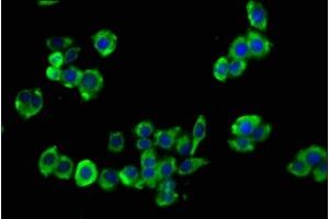 Immunofluorescence staining of PC-3 cells with ABIN7153687 at 1:133, counter-stained with DAPI. (CCKBR 抗体  (AA 243-333))