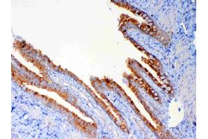 Immunohistochemistry (IHC) image for anti-Dynein, Light Chain, Tctex-Type 1 (DYNLT1) (AA 1-80) antibody (ABIN5693148)