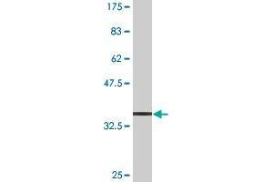 anti-ATP-Binding Cassette, Sub-Family B (MDR/TAP), Member 9 (ABCB9) (AA 482-580) antibody