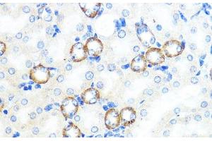Immunohistochemistry of paraffin-embedded Mouse kidney using NOD1 Polyclonal Antibody at dilution of 1:100 (40x lens). (NOD1 抗体)