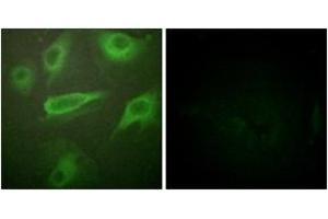 Immunofluorescence analysis of HeLa cells, using IL-4R/CD124 (Phospho-Tyr497) Antibody. (IL4 Receptor 抗体  (pTyr497))