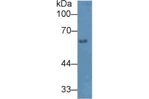 Detection of HPSE in Mouse Skin lysate using Polyclonal Antibody to Heparanase (HPSE) (HPSE 抗体  (AA 353-464))