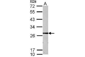 WB Image Sample (30 ug of whole cell lysate) A: HepG2 12% SDS PAGE antibody diluted at 1:1000 (MMAB 抗体  (Center))