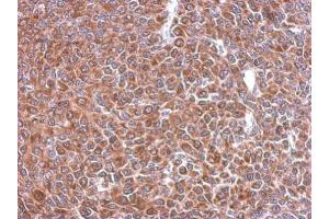 IHC-P Image Immunohistochemical analysis of paraffin-embedded BT483 xenograft, using STIP1, antibody at 1:500 dilution. (STIP1 抗体)
