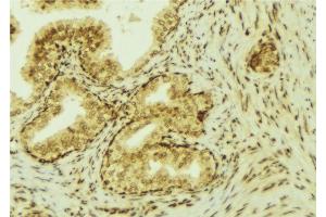 ABIN6277270 at 1/100 staining Mouse colon tissue by IHC-P. (VEGFC 抗体  (Internal Region))