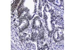 IHC testing of FFPE rat lung tissue with SF1 antibody at 1ug/ml. (Splicing Factor 1 抗体)