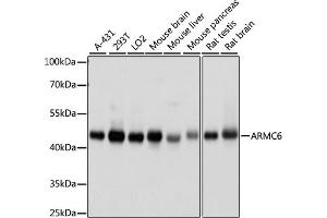 Western blot analysis of extracts of various cell lines, using  antibody (ABIN7265674) at 1000 dilution. (ARMC6 抗体  (AA 1-220))