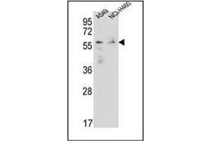 Western blot analysis of FOXN1 Antibody (Center) in A549,NCI-H460 cell line lysates (35ug/lane).