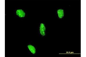 Immunofluorescence of monoclonal antibody to LHX3 on HeLa cell. (LHX3 抗体  (AA 228-316))