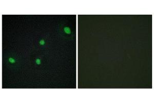 Immunofluorescence (IF) image for anti-Cell Division Cycle Associated 4 (CDCA4) (Internal Region) antibody (ABIN1850258)