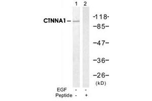 Western blot analysis of extract from A-431 cells, untreated or treated with EGF (200ng/ml, 30min), using CTNNA1 polyclonal antibody (Cat # PAB12225, Lane 1 and 2). (CTNNA1 抗体  (Ser641))