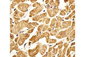 Immunohistochemical analysis of paraffin-embedded human heart section using ROR1 antibody. (ROR1 抗体)
