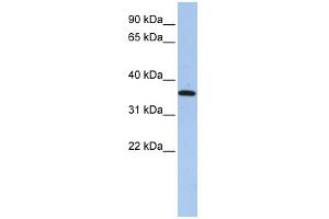 WB Suggested Anti-FAM84A Antibody Titration: 0. (FAM84A 抗体  (N-Term))