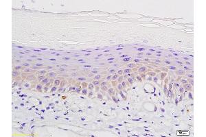 Formalin-fixed and paraffin embedded mouse skin labeled with Anti-°-Opioid receptor Polyclonal Antibody, Unconjugated (ABIN701755) followed by conjugation to the secondary antibody and DAB staining (Mu Opioid Receptor 1 抗体  (AA 165-270))