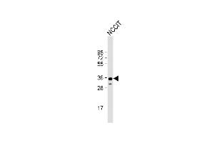 Anti-SOX2 Antibody  at 1:1000 dilution + NCCIT whole cell lysate Lysates/proteins at 20 μg per lane. (SOX2 抗体  (AA 251-284))