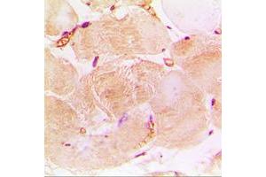 Immunohistochemical analysis of cTnI staining in human heart formalin fixed paraffin embedded tissue section. (TNNI3 抗体  (Center))