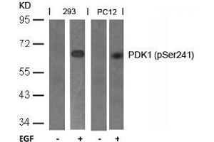 Image no. 2 for anti-3-phosphoinositide Dependent Protein Kinase-1 (PDPK1) (pSer241) antibody (ABIN196616) (PDPK1 抗体  (pSer241))