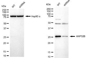 Western blotting analysis using ANP32B antibody (ABIN7797448). (Recombinant ANP32B 抗体)