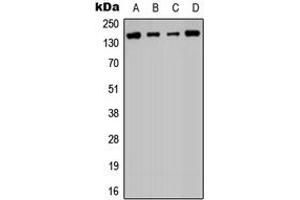 Western blot analysis of Histone Deacetylase 6 expression in PC3 (A), Jurkat (B), NIH3T3 (C), rat liver (D) whole cell lysates.