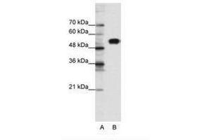 Image no. 1 for anti-Chloride Channel Kb (CLCNKB) (N-Term) antibody (ABIN6735463) (CLCNKB 抗体  (N-Term))