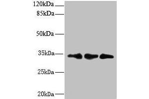 Western blot All lanes: CNOT9 antibody at 6 μg/mL Lane 1: HepG2 whole cell lysate Lane 2: Mouse small intestine tissue Lane 3: Mouse spleen tissue Secondary Goat polyclonal to rabbit IgG at 1/10000 dilution Predicted band size: 34, 37, 30 kDa Observed band size: 34 kDa (RQCD1 抗体  (AA 1-258))