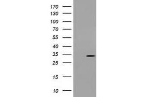 Western Blotting (WB) image for anti-Uridine-Cytidine Kinase 1 (UCK1) antibody (ABIN1501666) (UCK1 抗体)