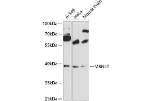 Western blot analysis of extracts of various cell lines, using MBNL2 antibody (ABIN6132336, ABIN6143603, ABIN6143604 and ABIN6216609) at 1:3000 dilution. (MBNL2 抗体  (AA 160-260))