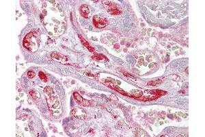 Immunohistochemistry (IHC) image for anti-Protein Phosphatase 2, Regulatory Subunit B'', alpha (PPP2R3A) (AA 179-228) antibody (ABIN6748633)