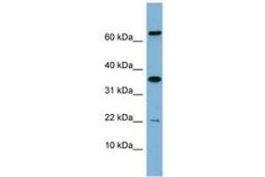 Image no. 1 for anti-RWD Domain Containing 1 (RWDD1) (AA 71-120) antibody (ABIN6741945) (RWDD1 抗体  (AA 71-120))