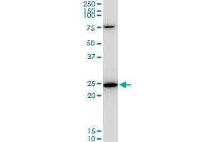 TPT1 monoclonal antibody (M06), clone 2A3. (TPT1 抗体  (AA 35-138))
