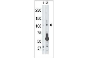 Image no. 1 for anti-Mitogen-Activated Protein Kinase Kinase Kinase 14 (MAP3K14) (Middle Region) antibody (ABIN360384) (MAP3K14 抗体  (Middle Region))