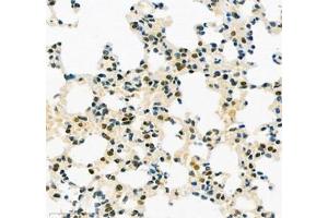 Immunohistochemistry (Paraffin-embedded Sections) (IHC (p)) image for anti-TEA Domain Family Member 3 (TEAD3) antibody (ABIN7075852)