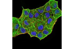 Immunofluorescence analysis of MCF-7 cells using CK5 mouse mAb (green). (Cytokeratin 5 抗体  (AA 258-357))