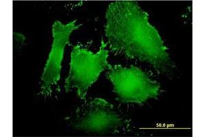 Immunofluorescence (IF) image for anti-Membrane Associated Guanylate Kinase, WW and PDZ Domain Containing 1 (MAGI1) (AA 761-859) antibody (ABIN563984)