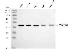 Western blot analysis of TRMT2B using anti-TRMT2B antibody (ABIN7599456).