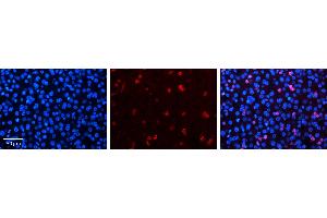 NR2F6 antibody - N-terminal region          Formalin Fixed Paraffin Embedded Tissue:  Human Liver Tissue    Observed Staining:  Nucleus in hepatocytes   Primary Antibody Concentration:  1:100    Secondary Antibody:  Donkey anti-Rabbit-Cy3    Secondary Antibody Concentration:  1:200    Magnification:  20X    Exposure Time:  0.